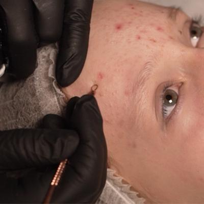 Klasikinis veido valymas