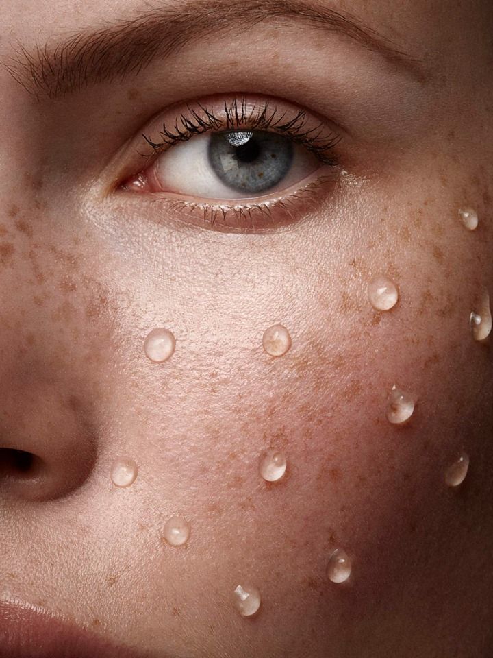 Aukščiausio standarto EGZOSOMŲ terapija su spikulėmis - be adatų!