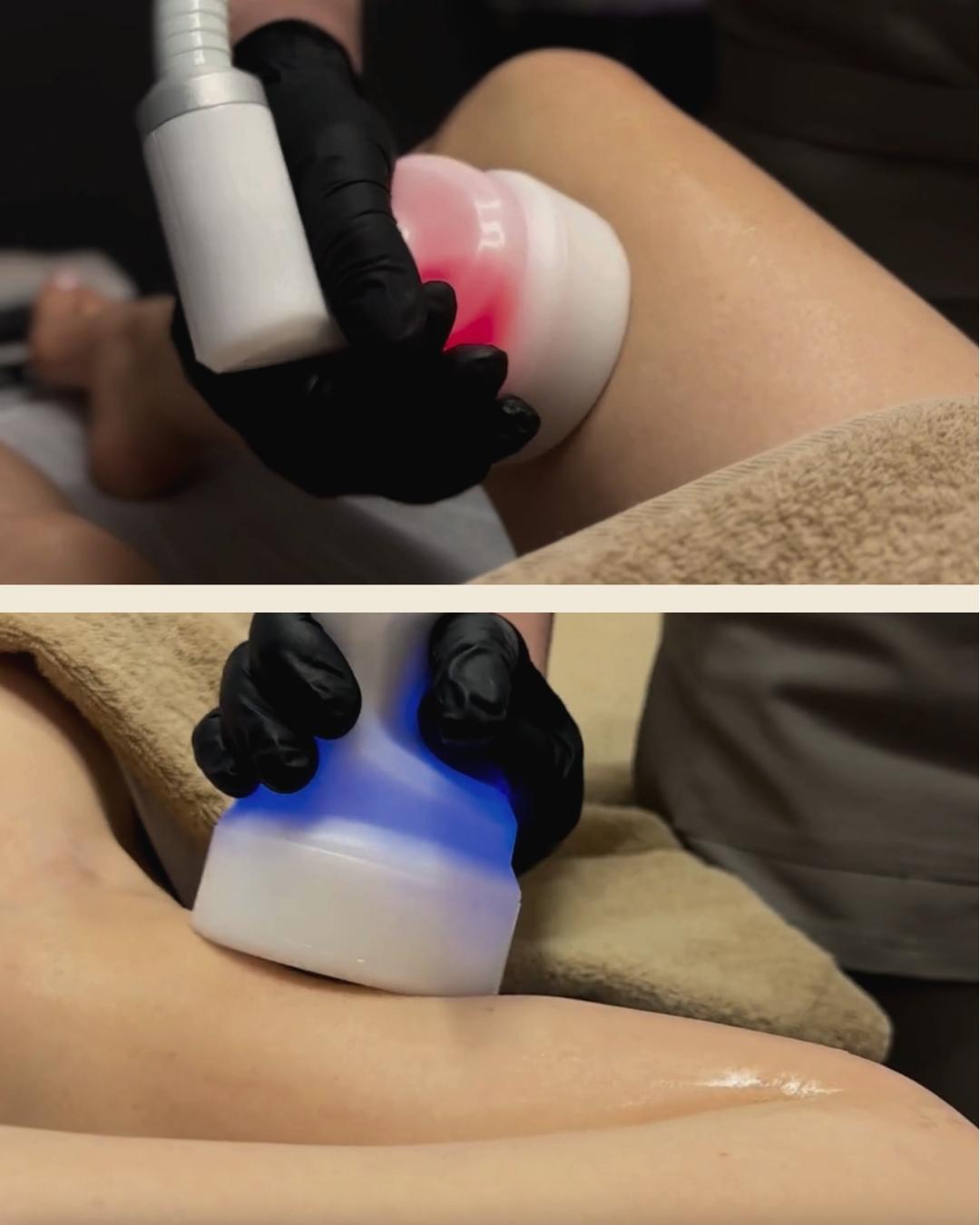 CRYO T SHOCK | Rankos