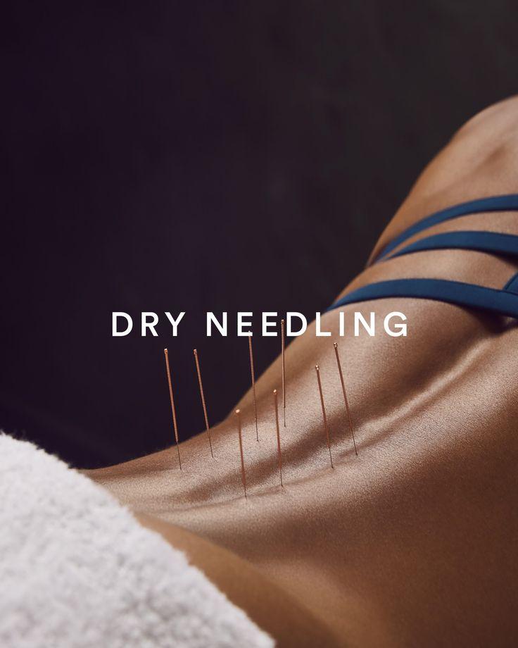 Sausos adatos terapija (Dry Needling)